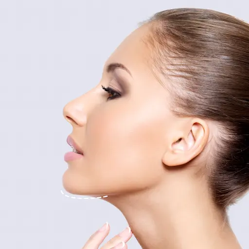 Chin Filler Liverpool